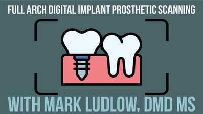 Episode 142: Full Arch Digital Implant Prosthetic Scanning with Mark Ludlow, DMD MS