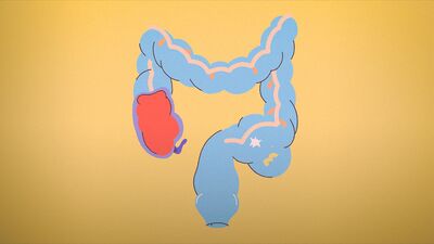 Inutile d'être constipé si on ne fait pas popot une fois par jour | Jen Gunter