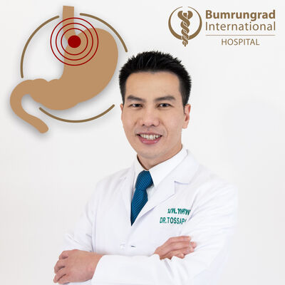 Why you shouldn't delay care for chronic acid reflux