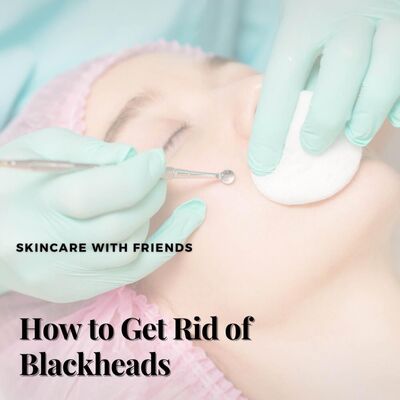 80. How to Get Rid of Blackheads