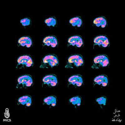 قصة قصيرة: يُسابق كلمة ويتعثر بعشر
