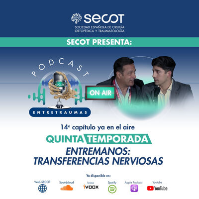 ENTREMANOS: transferencias nerviosas