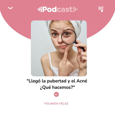 209. El acné y todo lo que debes tener en cuenta