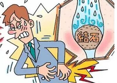 胆石症患者饮食需要注意 中医饮食疗法助排石