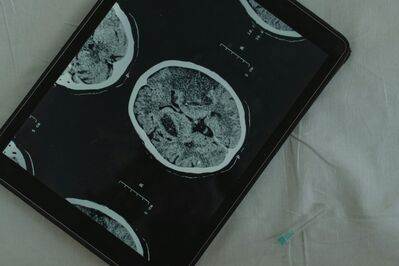 Los fenómenos más extraños que pueden suceder en nuestras mentes
