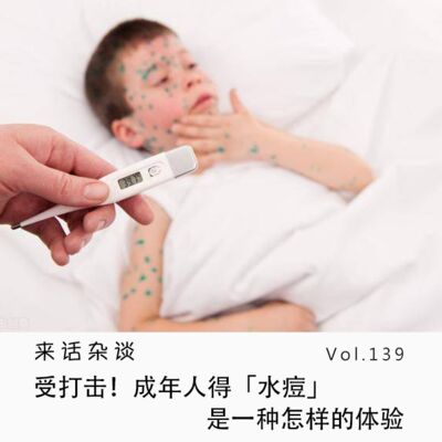 Vol.139 受打击！成年人得「水痘」是一种怎样的体验
