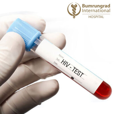 Living a normal life with HIV