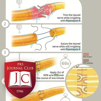 Recovery after Peripheral Nerve Injury” with Harvey Chim, MD - Dec. 2024 Journal Club