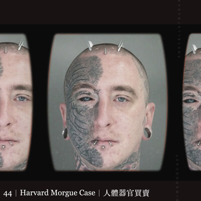 44｜Harvard Morgue Case｜人體器官買賣