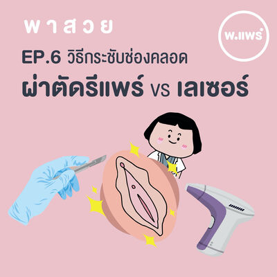 พาสวย EP.6 วิธีช่วยกระชับช่องคลอด (ผ่าตัดรีแพร์ VS เลเซอร์)