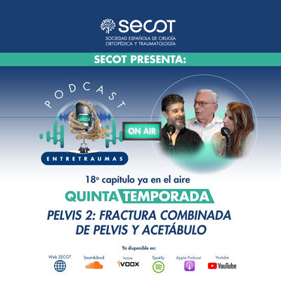 Pelvis 2: Fractura combinada de pelvis y acetábulo