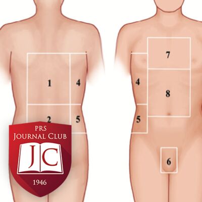 Multiple Perforator Propeller Flaps” with Harvey Chim, MD - Dec. 2024 Journal Club