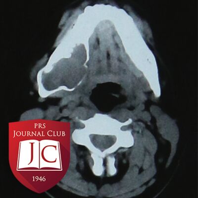 “Mandibular Reconstruction” with Scott Bartlett, MD - Nov. 2024 Journal Club