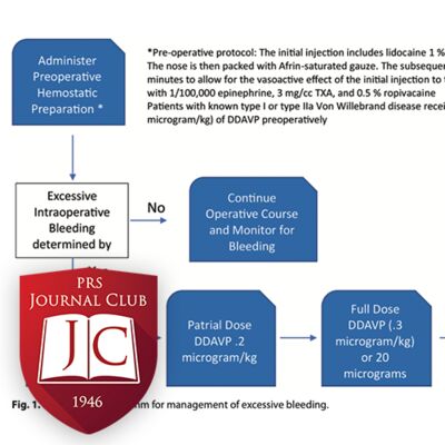 “Bleeding Control in Rhinoplasty” with Ira Savetsky, MD - Jan. 2025 Journal Club