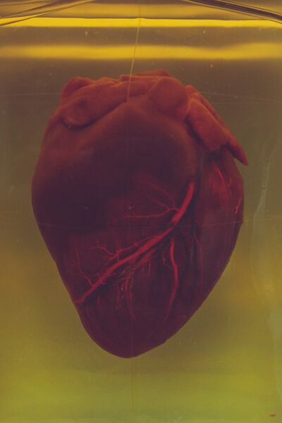 PODCAST: Il Cuore, Il Ladro e Dvesha