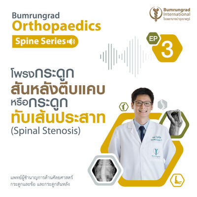 โพรงกระดูกสันหลังตีบแคบ หรือกระดูกทับเส้นประสาท