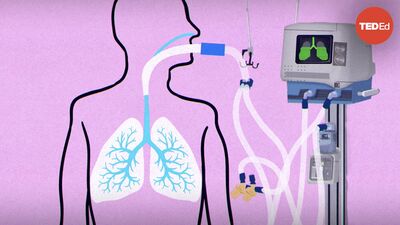 How do ventilators work? | Alex Gendler