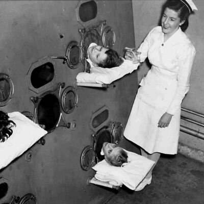 8. La polio, el virus que provoca parálisis