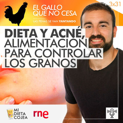 Dieta y acné, alimentación para controlar los granos | El gallo que no cesa 3x31