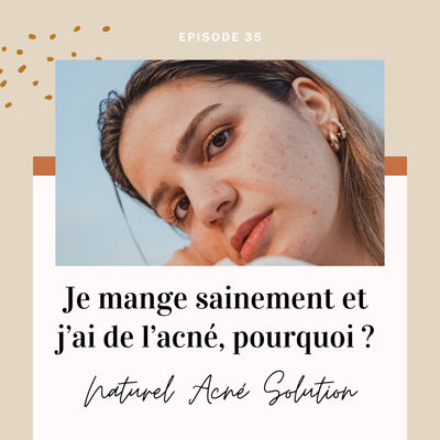 Episode 35 - Je mange sainement et j'ai de l'acné, pourquoi ?