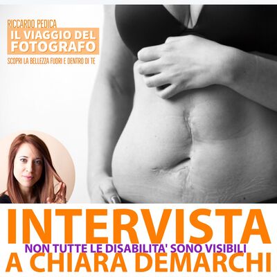Non tutte le disabilità sono visibili :Intervista a  Chiara De Marchi