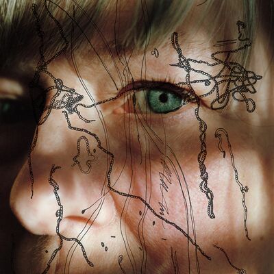 同病相憐 攝影師聚焦慢性萊姆病群體的隱形傷痛