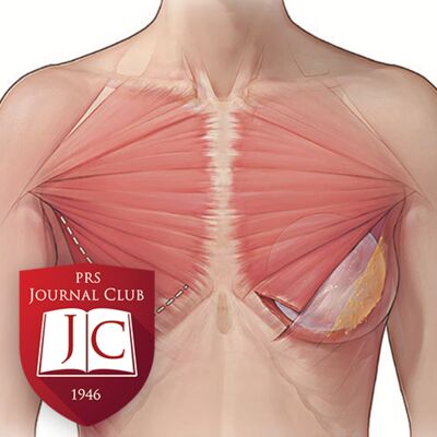 “Subfascial Mini Dual-Plane Augmentation” with Ira Savetsky, MD - Jan. 2025 Journal Club