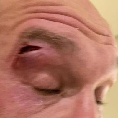 Fury vs Usyk is off! Fury Suffers a Cut in Sparring