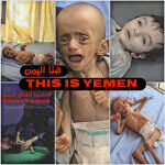 The War on Yemen: A Conversation with Dr. Aisha Jumaan